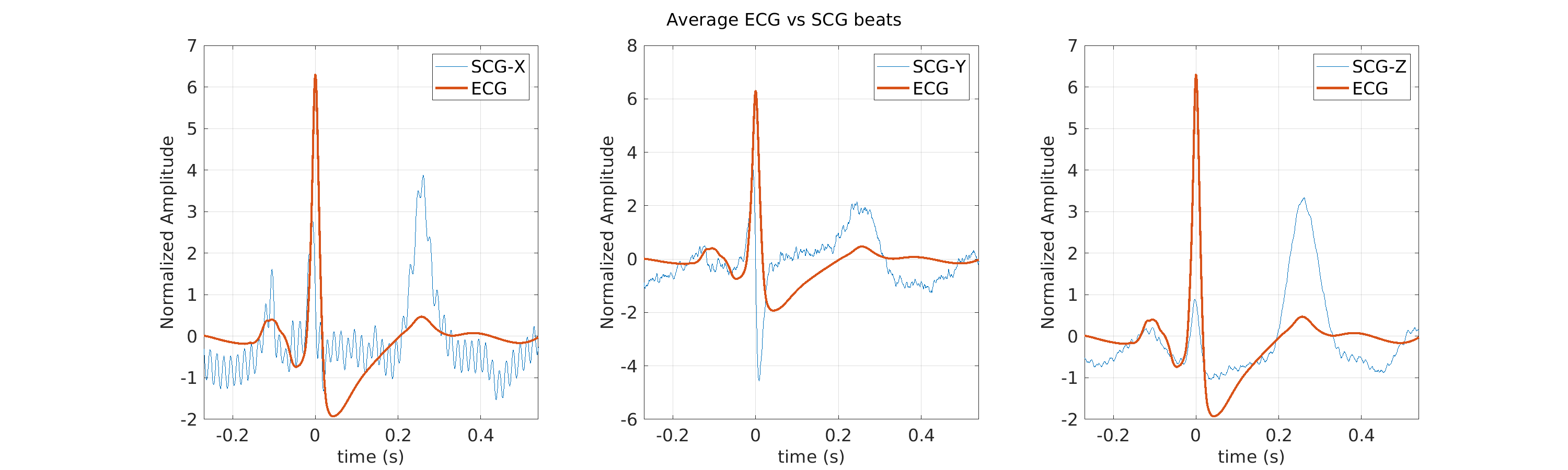 S010_scg_avg_ecg_scg