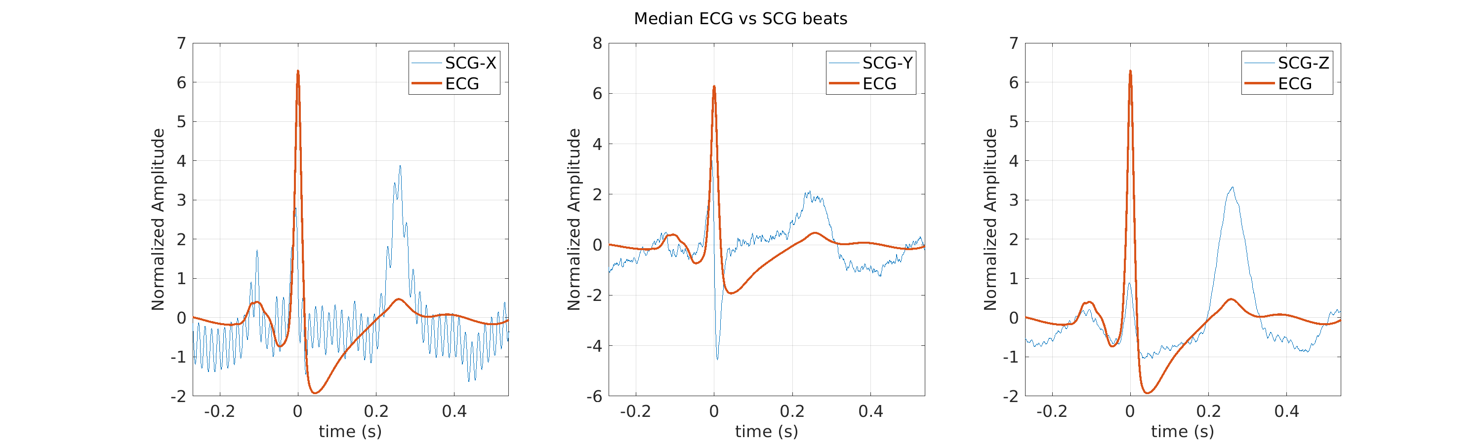 S010_scg_med_ecg_scg