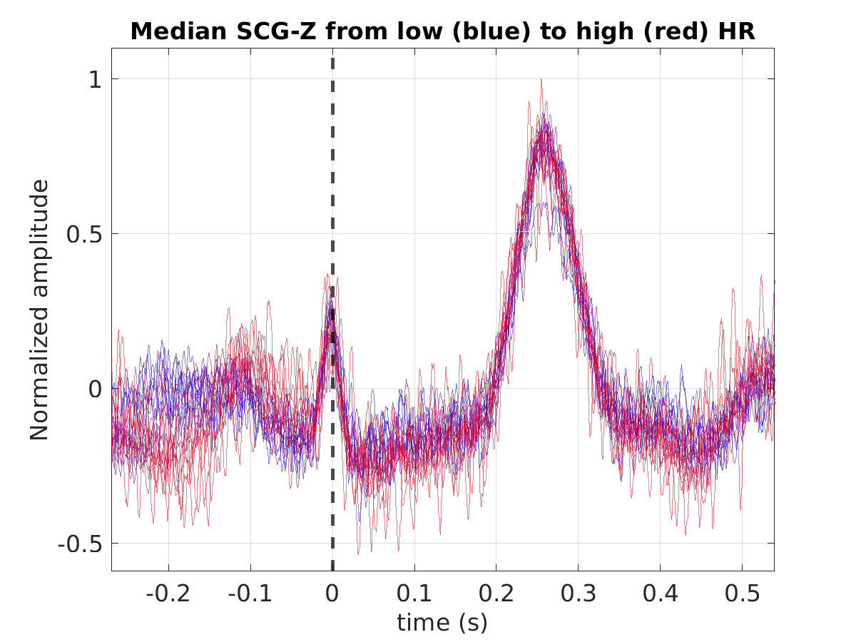 S010_scg_med_scgz_hr_binned_norm