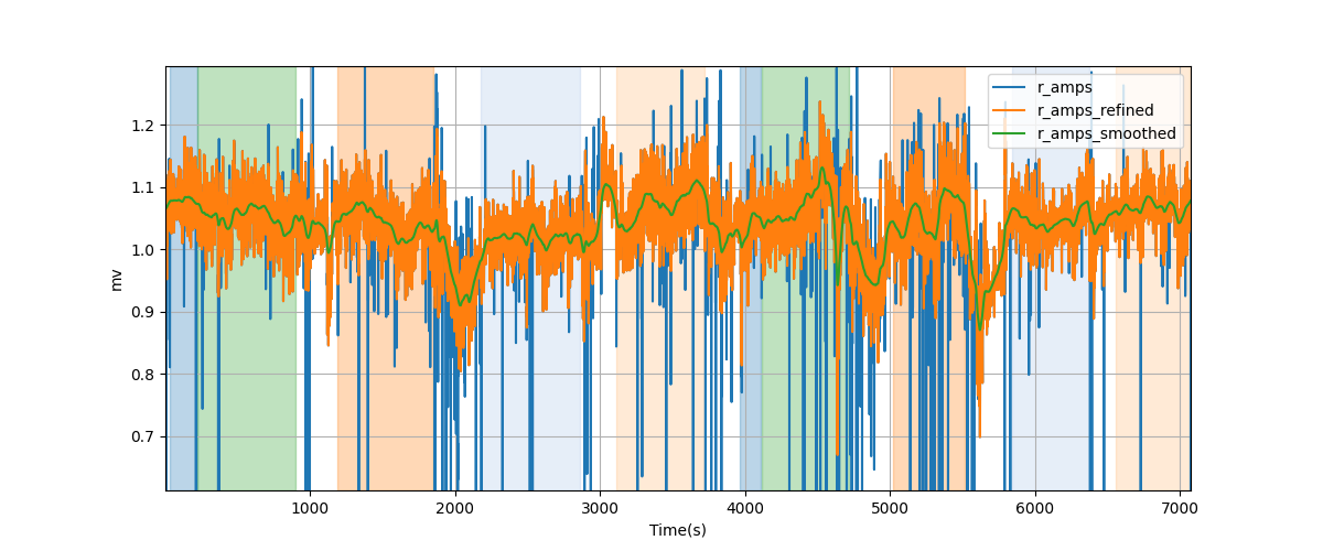 R-wave amplitudes - Overlay