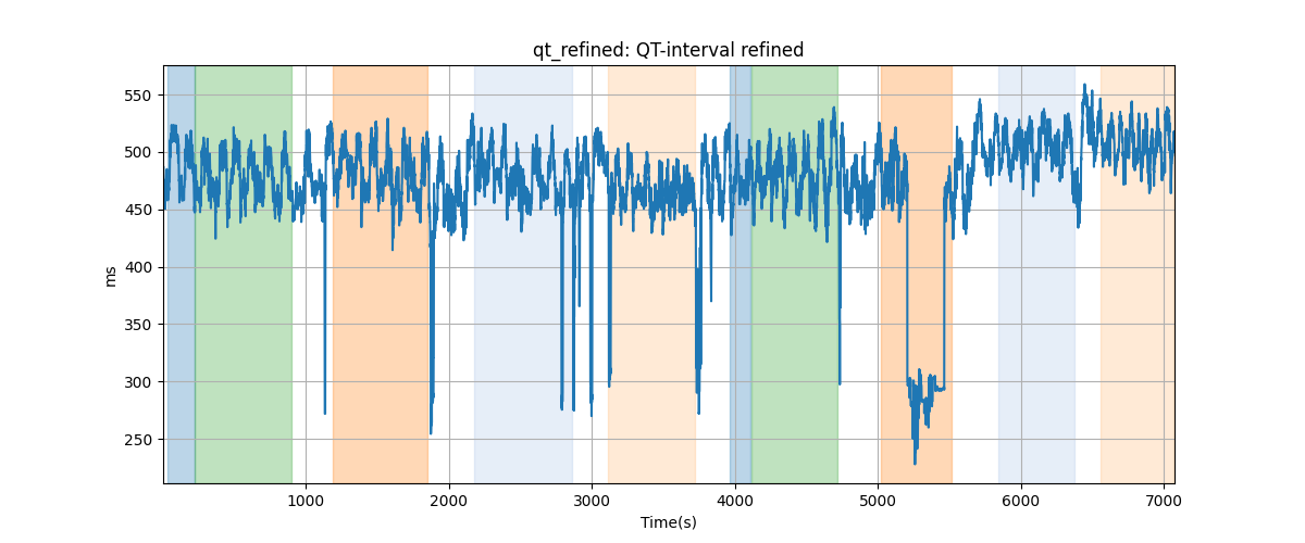 qt_refined: QT-interval refined