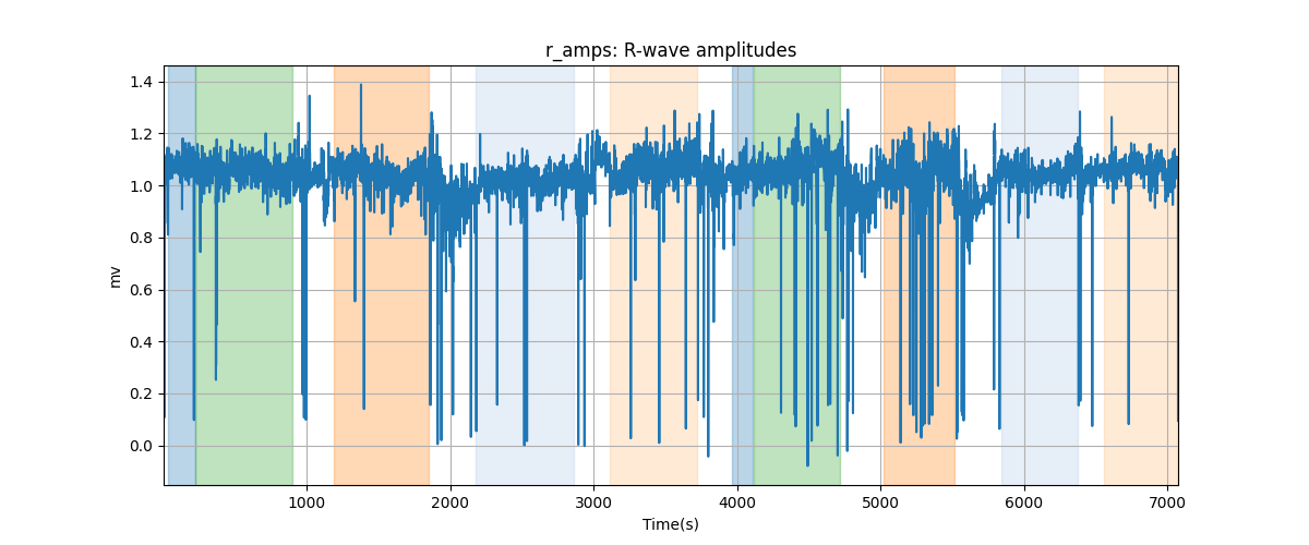 r_amps: R-wave amplitudes