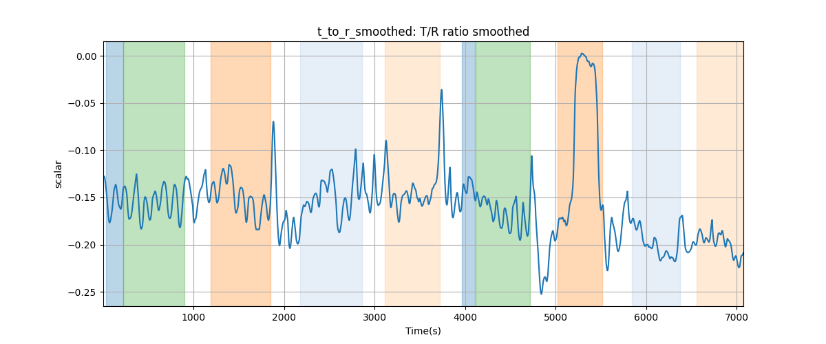 t_to_r_smoothed: T/R ratio smoothed