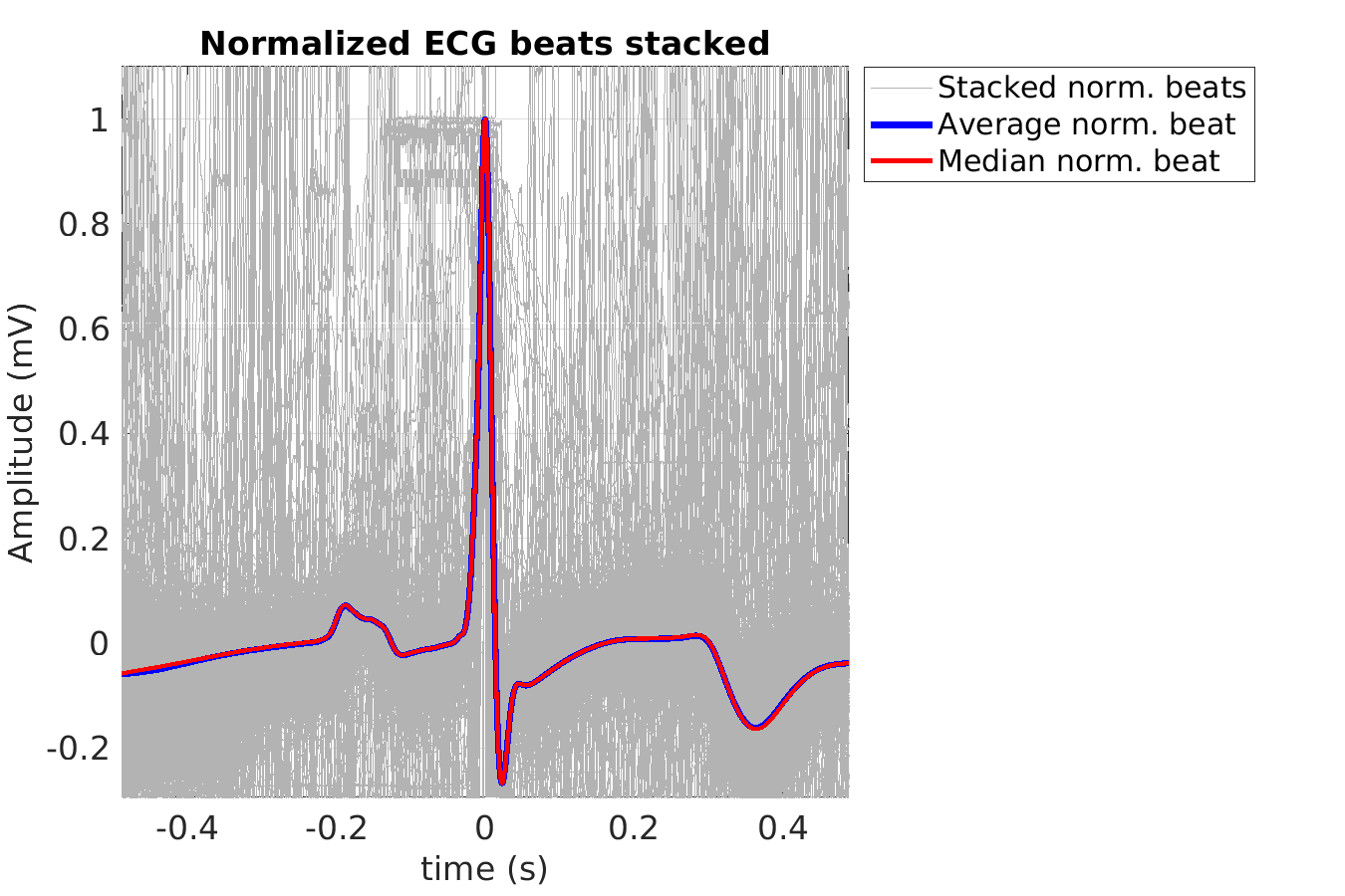 S011_ecg_norm_beats_stacked