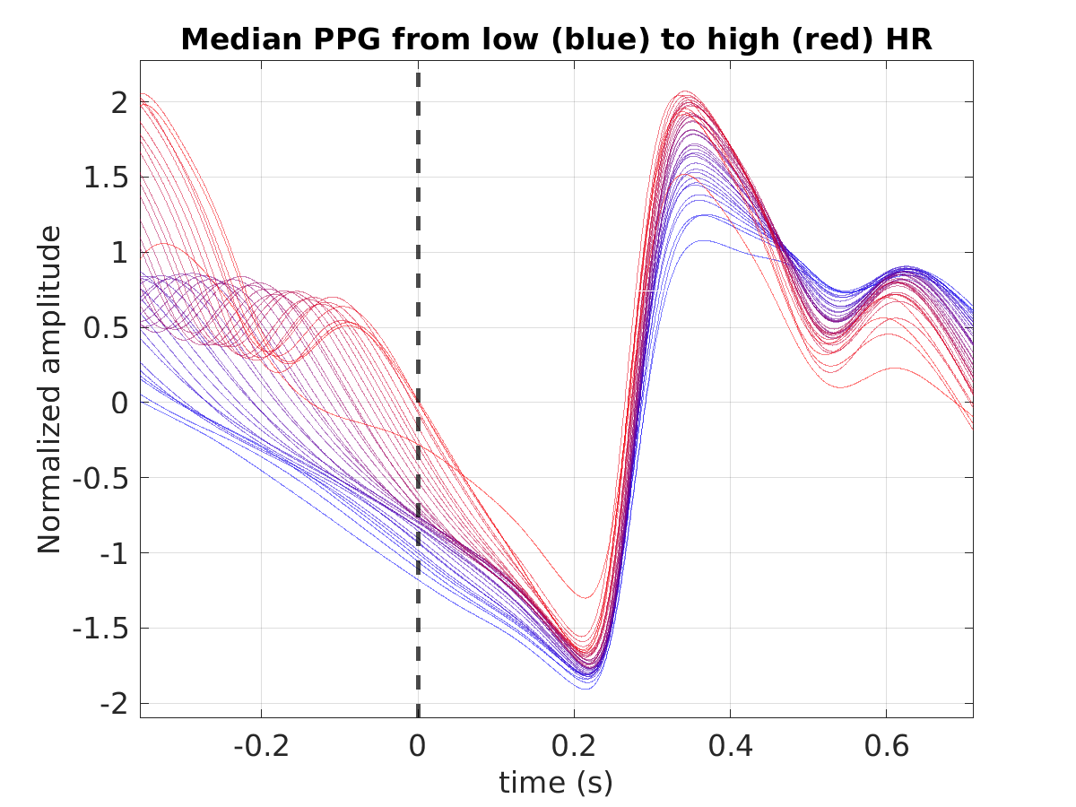 S011_ppg_med_ppg_hr_binned_norm