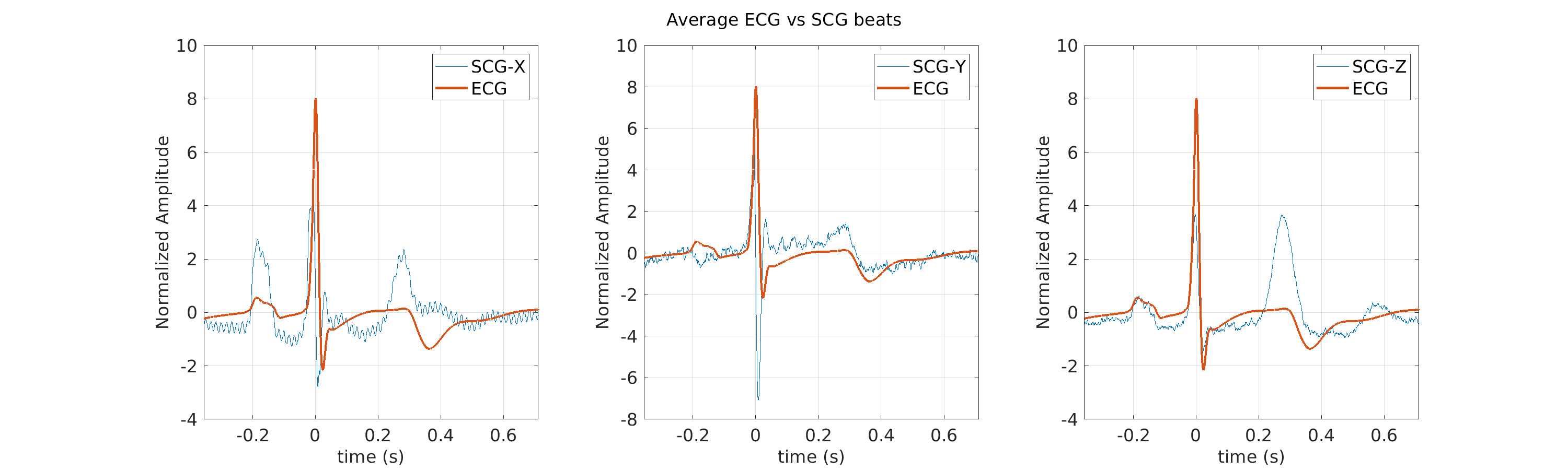 S011_scg_avg_ecg_scg