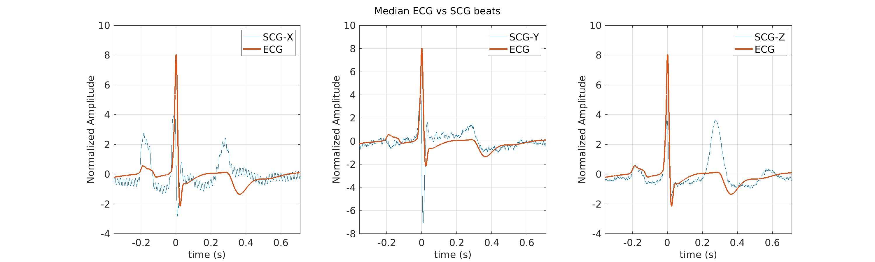 S011_scg_med_ecg_scg