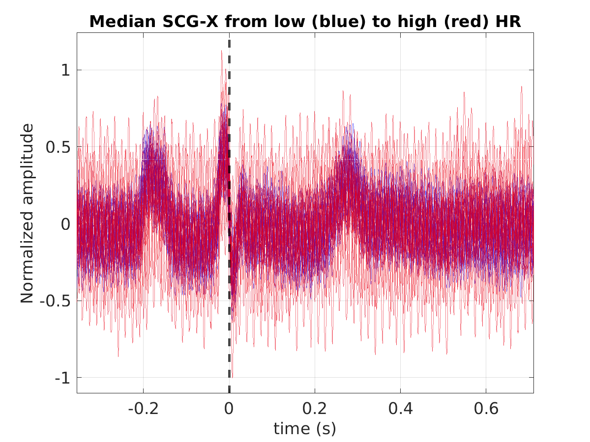 S011_scg_med_scgx_hr_binned_norm