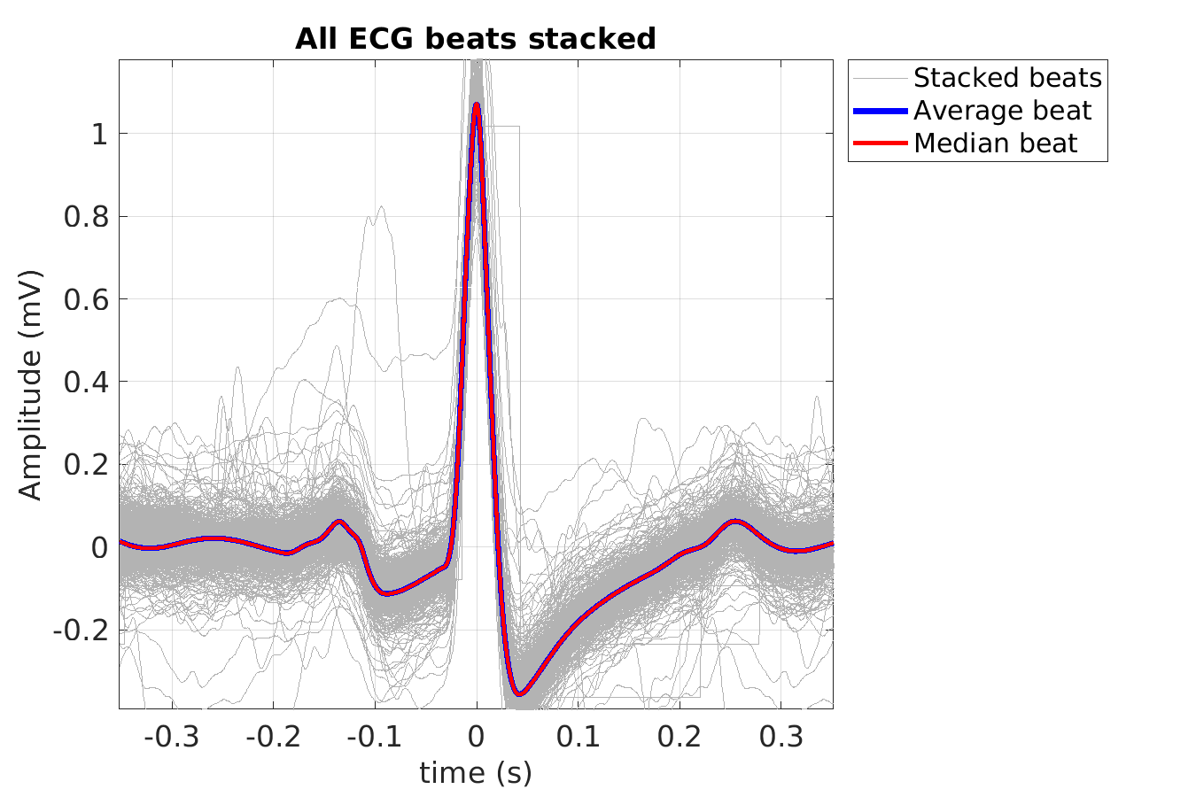 S012_ecg_beats_stacked