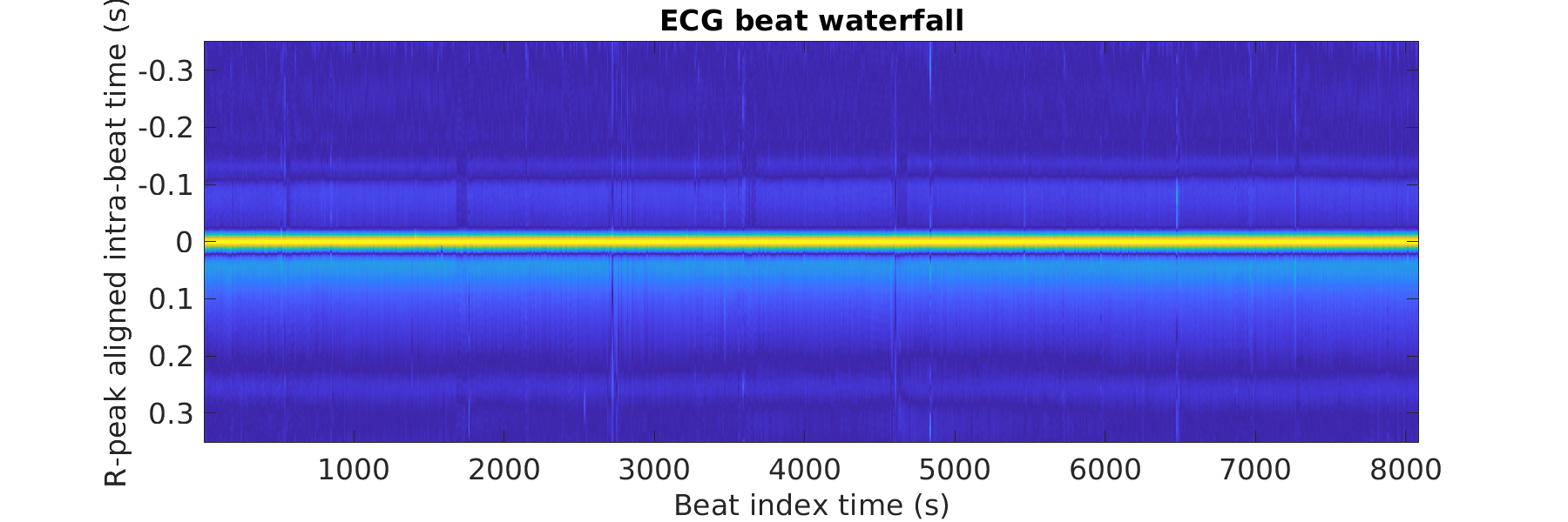 S012_ecg_beats_waterfall