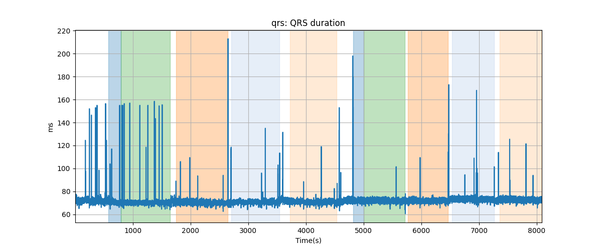 qrs: QRS duration