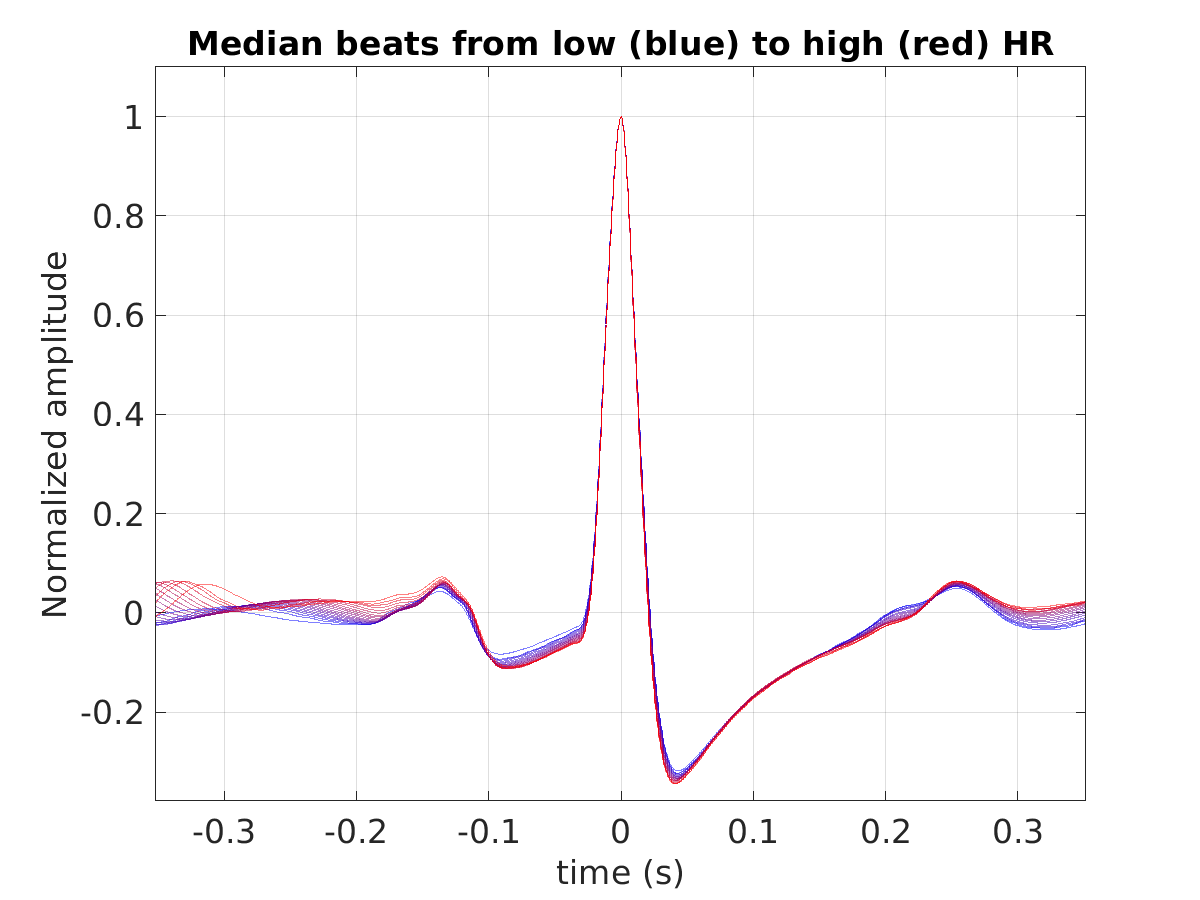 S012_ecg_med_beats_hr_binned