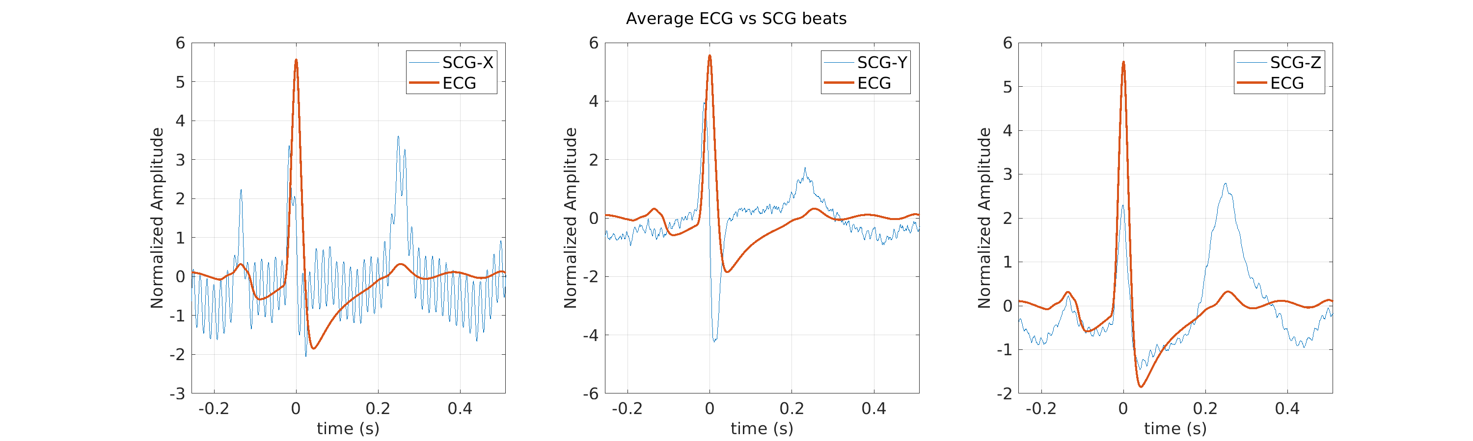 S012_scg_avg_ecg_scg