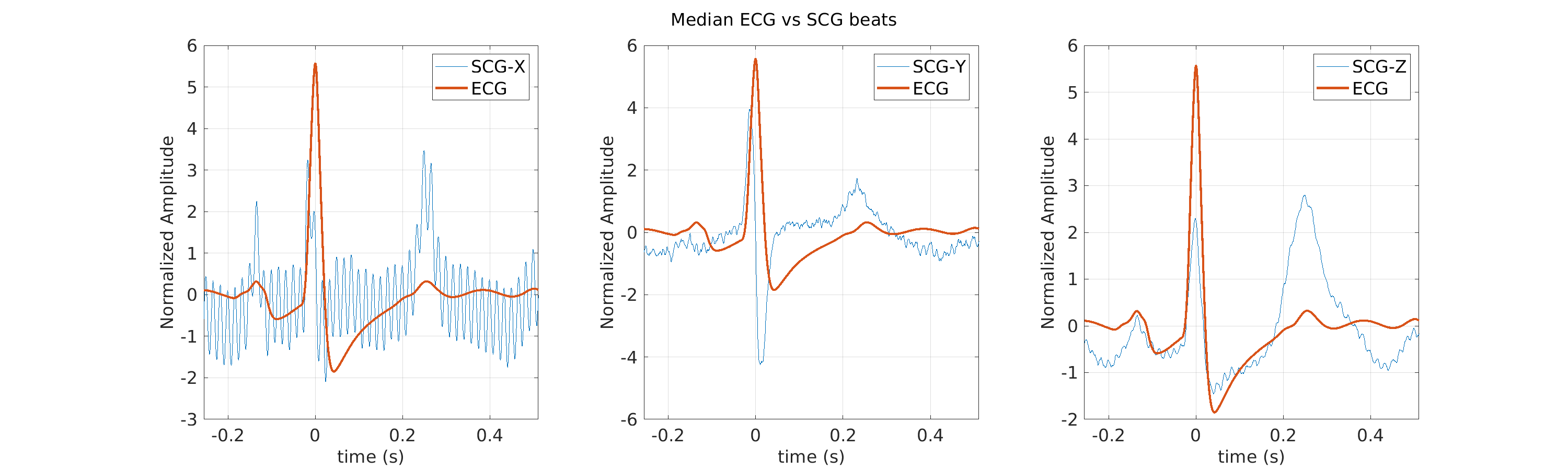 S012_scg_med_ecg_scg