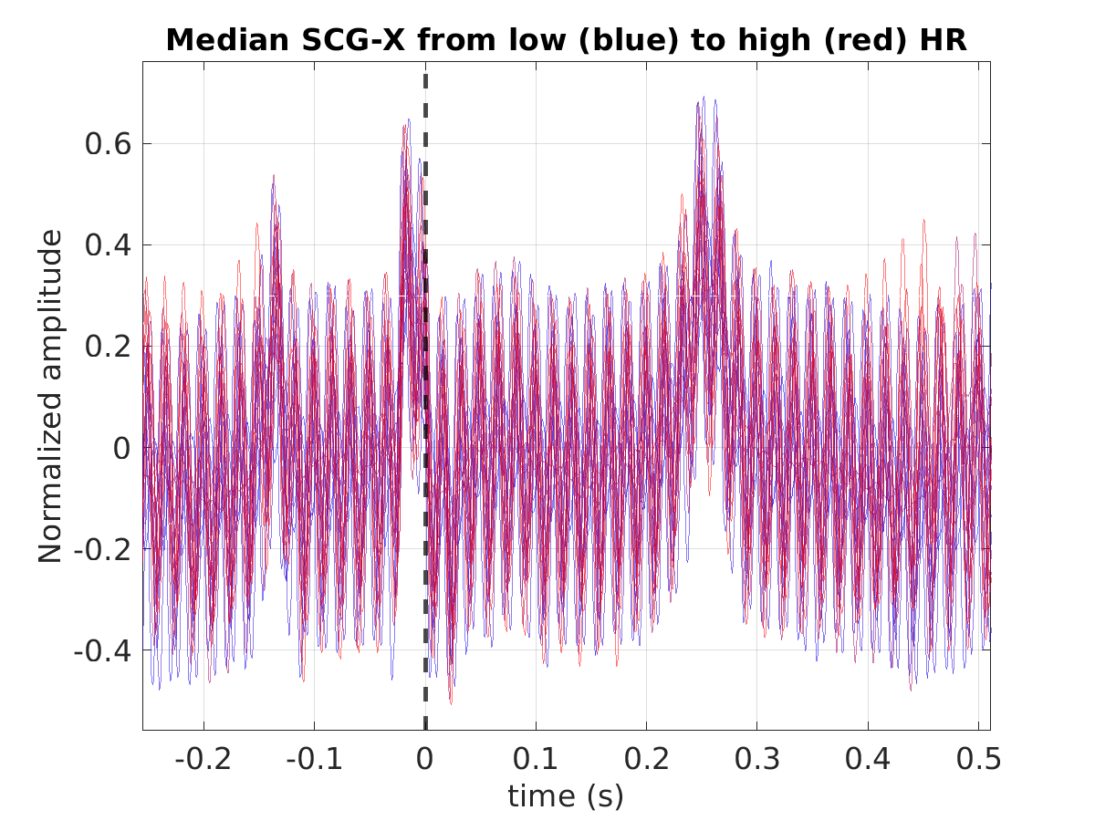 S012_scg_med_scgx_hr_binned_norm