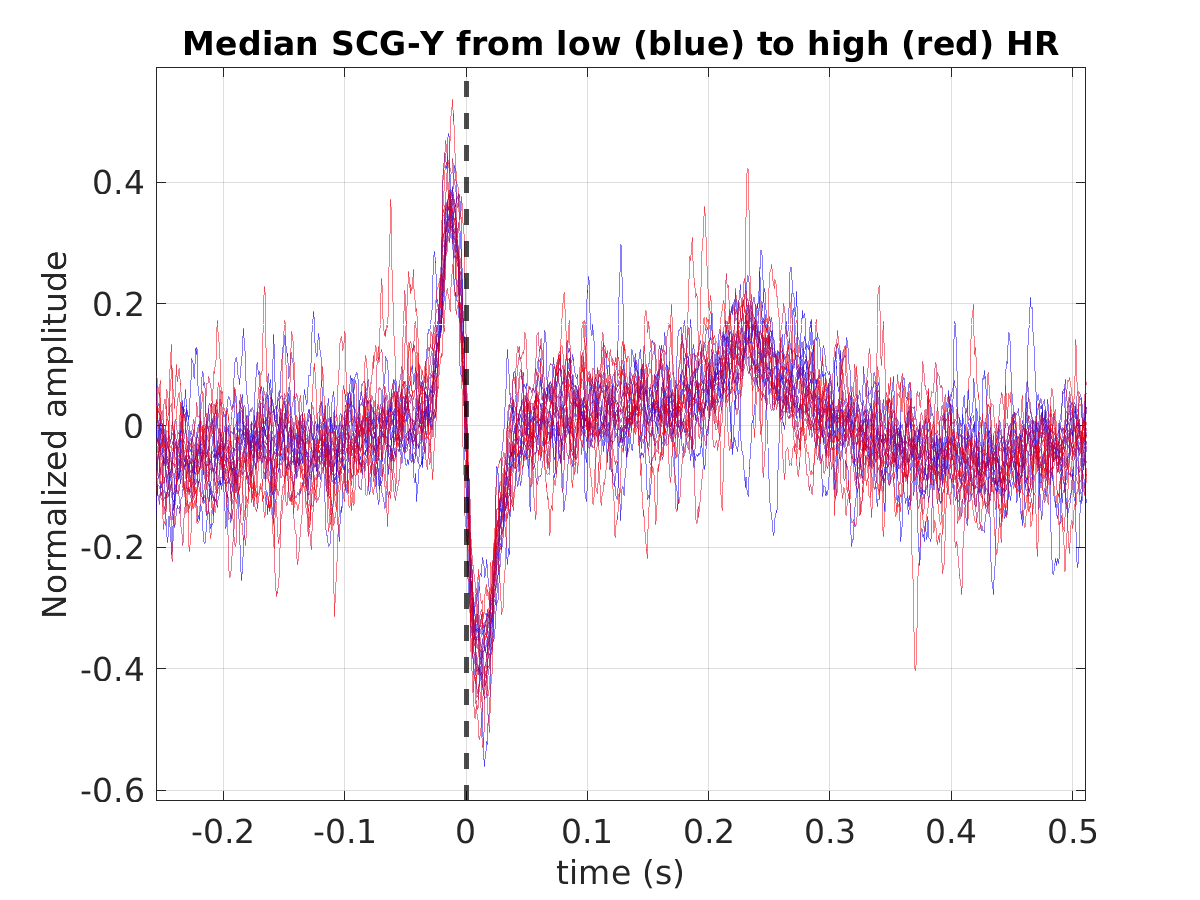 S012_scg_med_scgy_hr_binned_norm