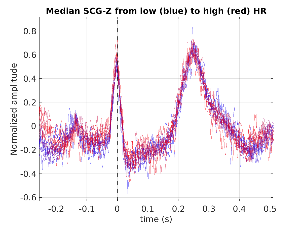 S012_scg_med_scgz_hr_binned_norm