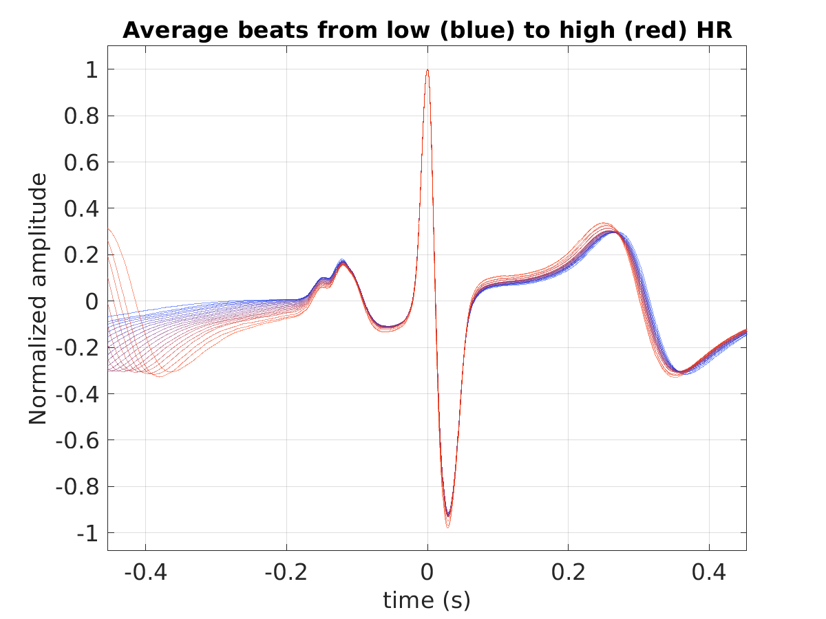 S014_ecg_avg_beats_hr_binned