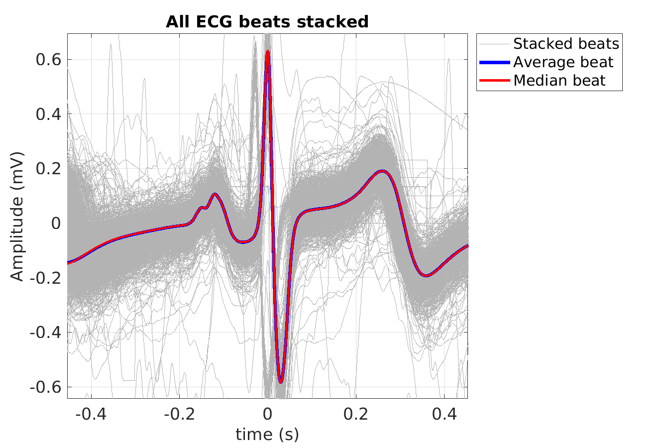 S014_ecg_beats_stacked