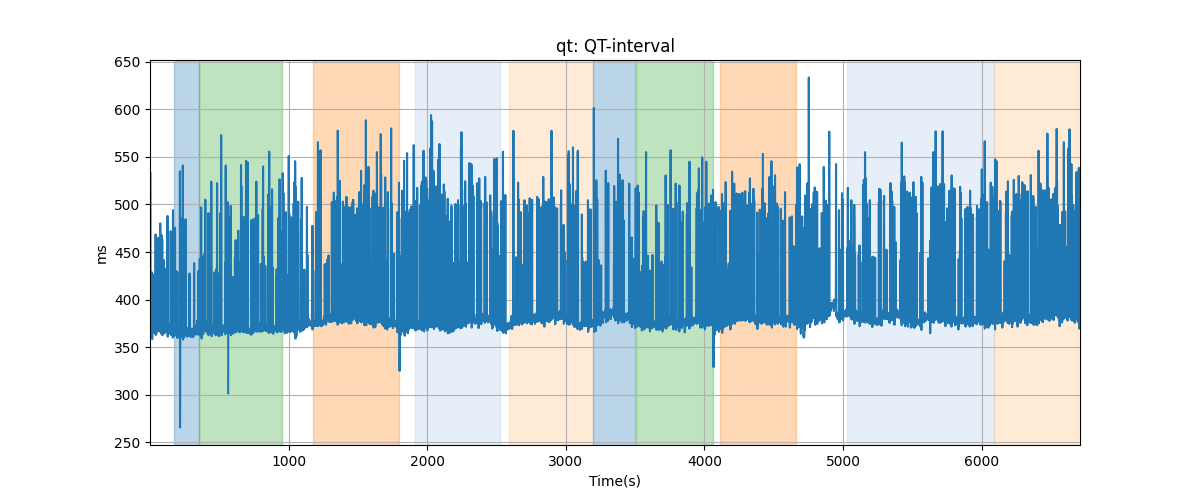 qt: QT-interval