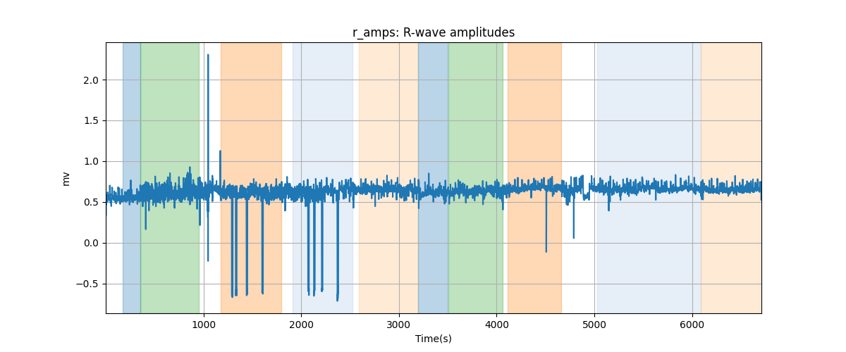 r_amps: R-wave amplitudes