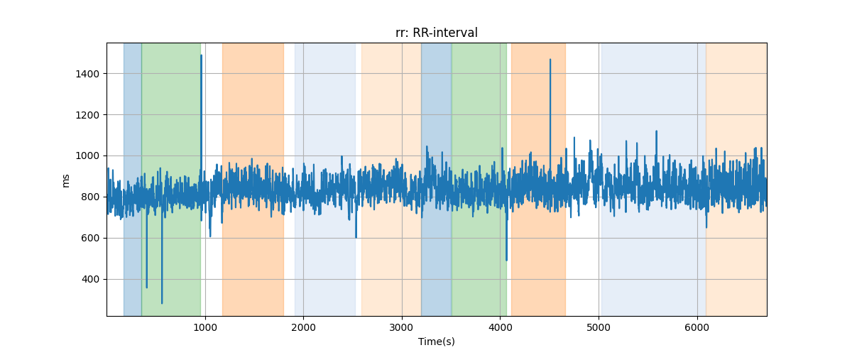 rr: RR-interval