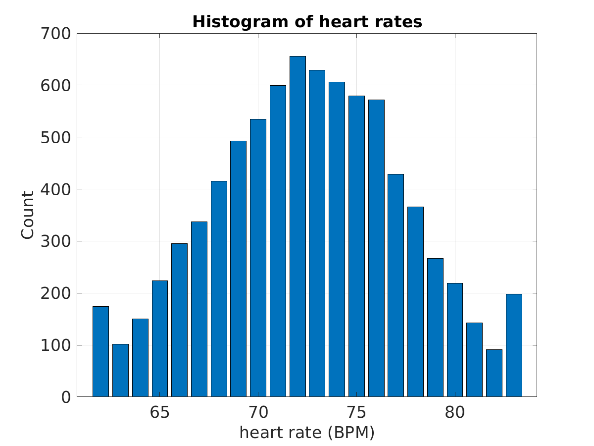 S014_ecg_hr_hist