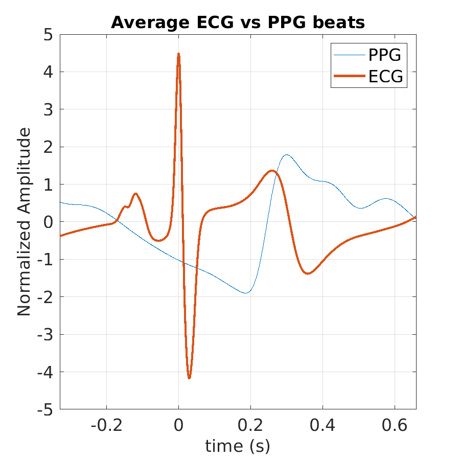 S014_ppg_avg_ecg_ppg