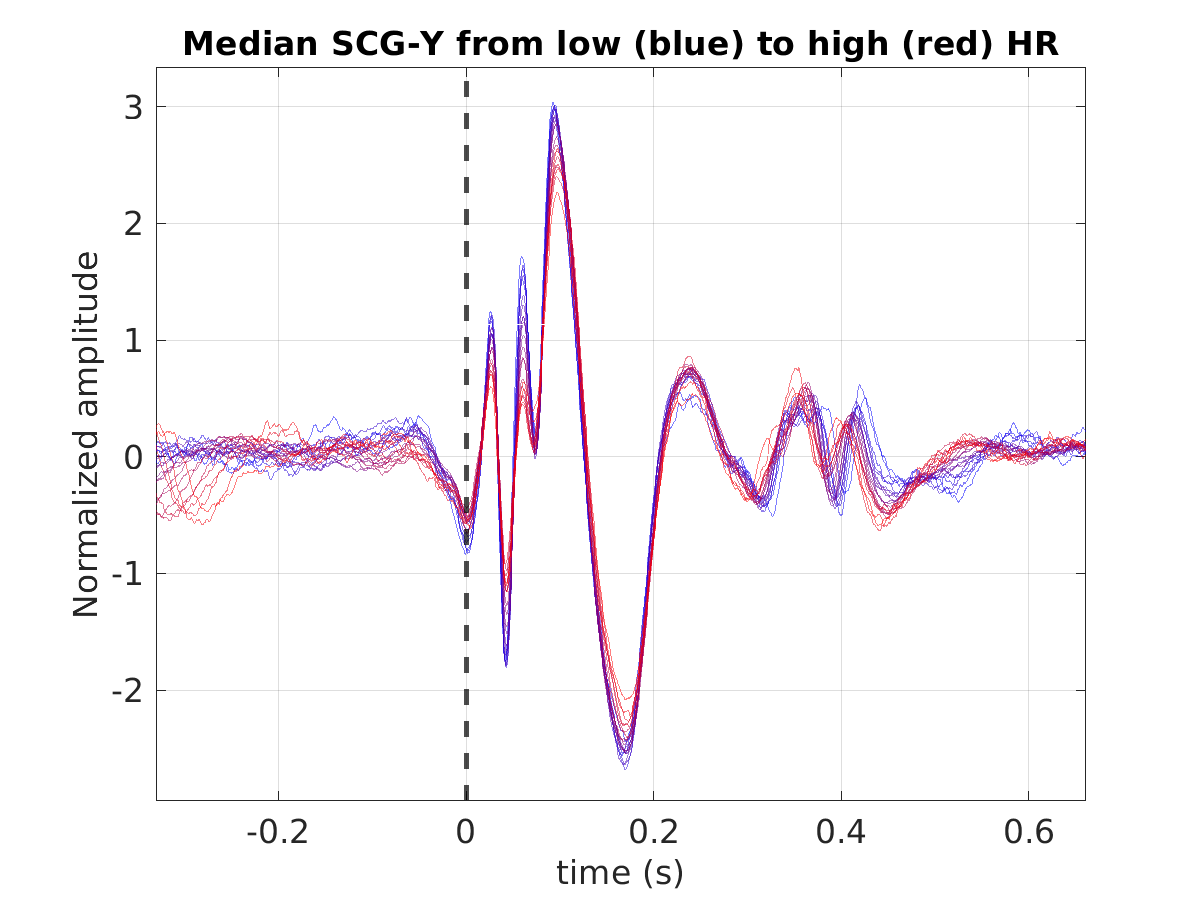 S014_scg_med_scgy_hr_binned_norm