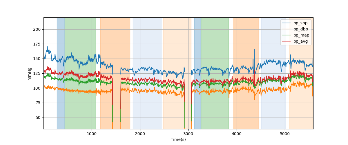 Subject S016 blood pressure data processing summary - Overlay