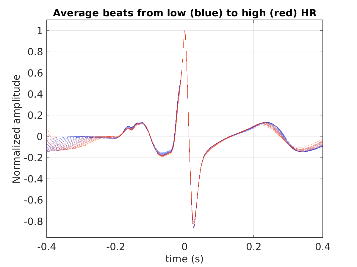 S016_ecg_avg_beats_hr_binned