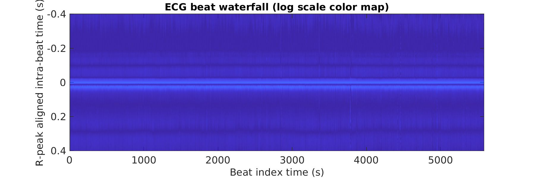 S016_ecg_beats_waterfall_logscale