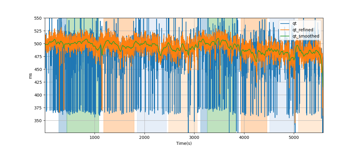 QT intervals - Overlay