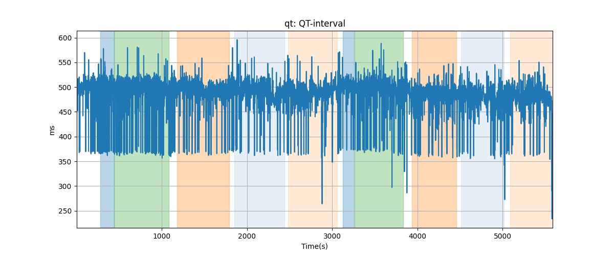 qt: QT-interval