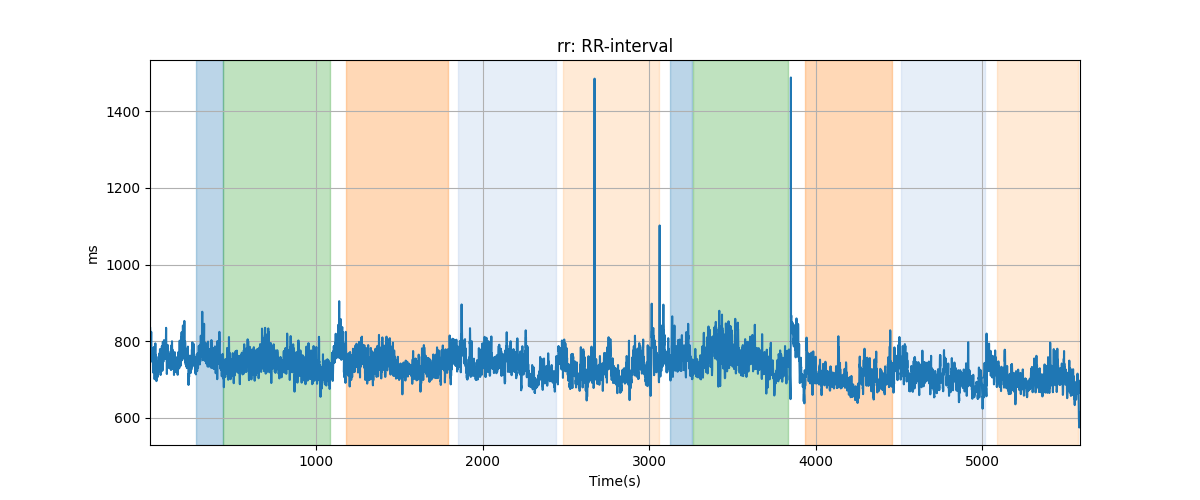 rr: RR-interval