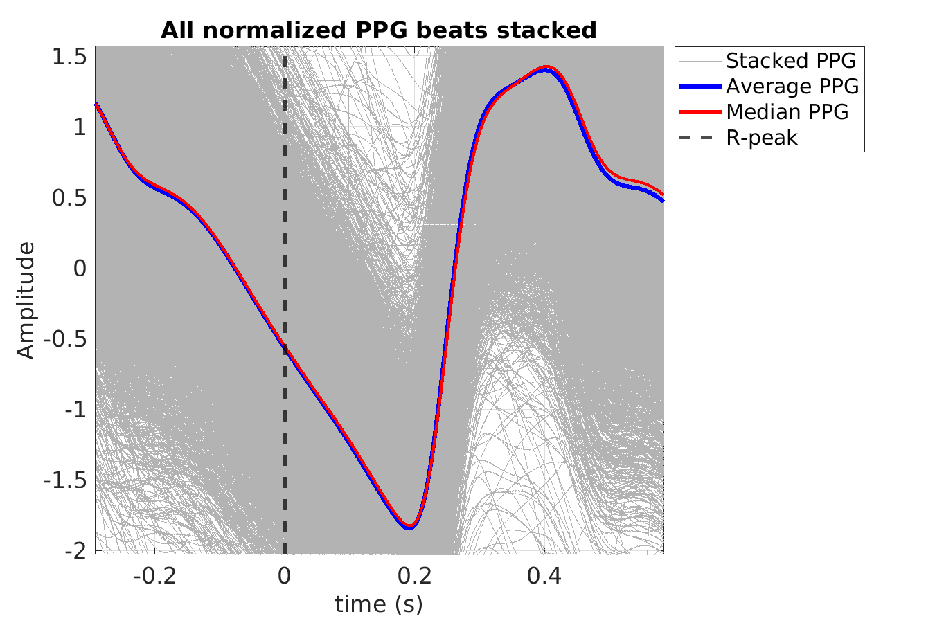 S016_ppg_ppg_stacked_norm