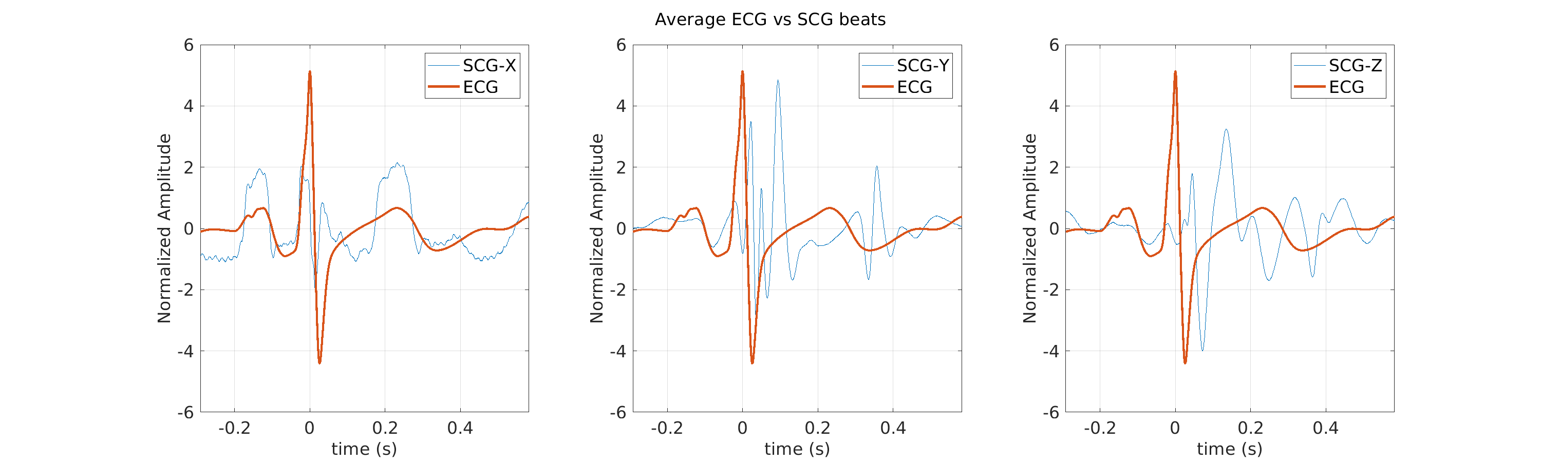 S016_scg_avg_ecg_scg