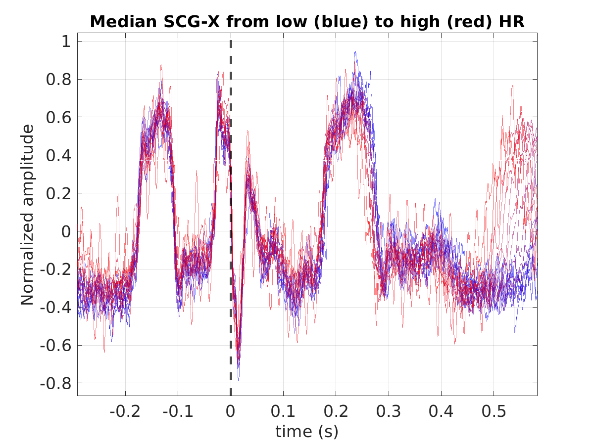 S016_scg_med_scgx_hr_binned_norm