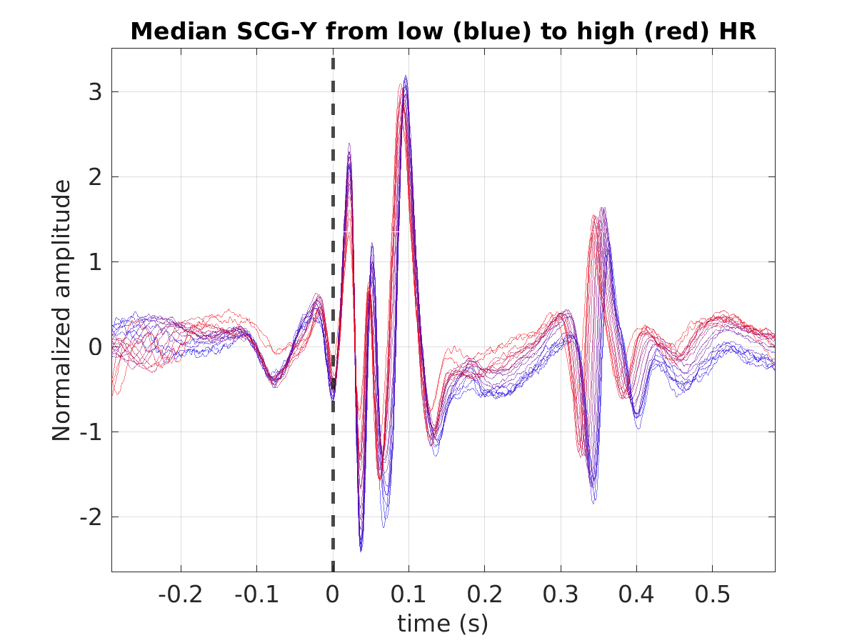 S016_scg_med_scgy_hr_binned_norm