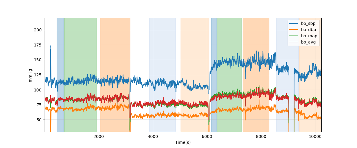 Subject S019 blood pressure data processing summary - Overlay