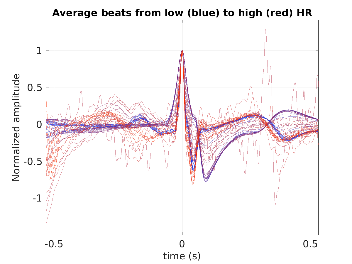 S019_ecg_avg_beats_hr_binned