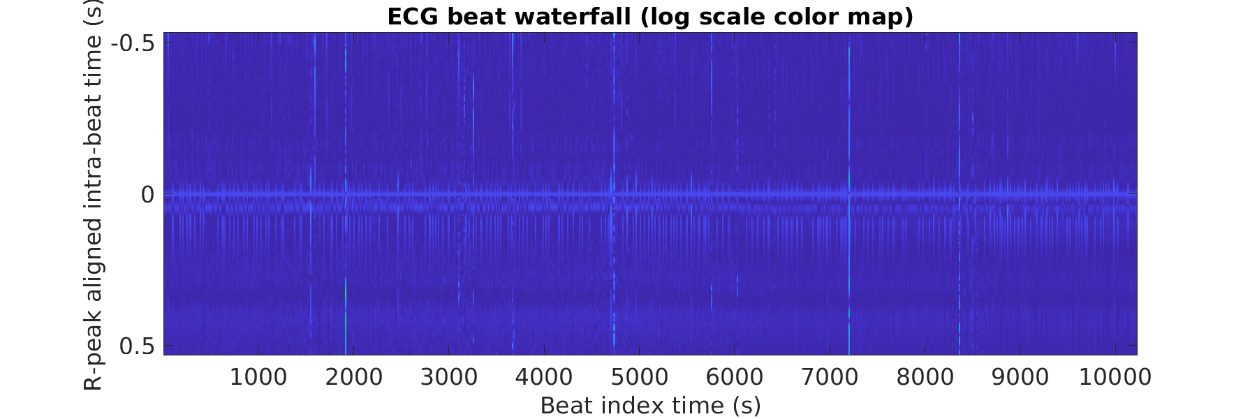 S019_ecg_beats_waterfall_logscale