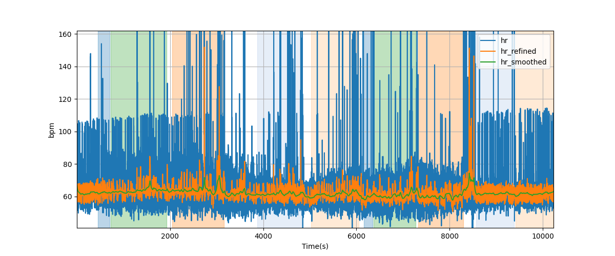 Heart rate - Overlay