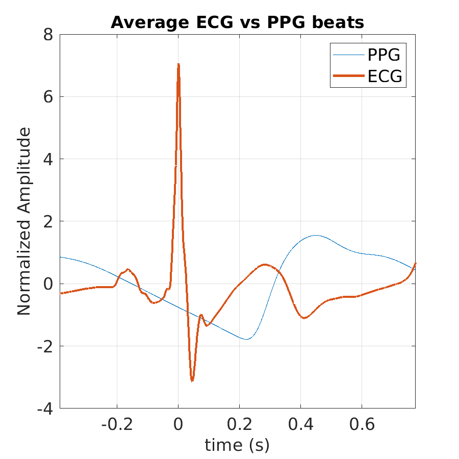 S019_ppg_avg_ecg_ppg