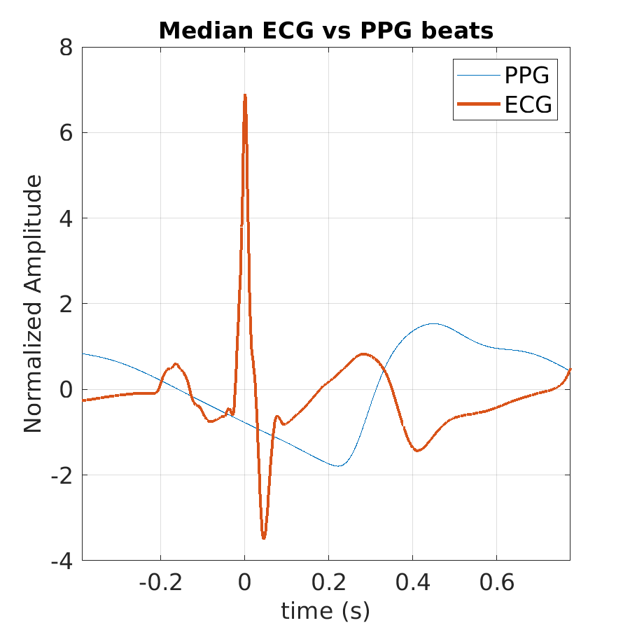 S019_ppg_med_ecg_ppg