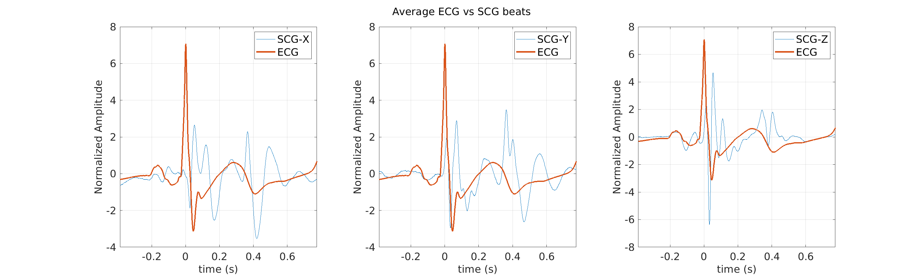 S019_scg_avg_ecg_scg