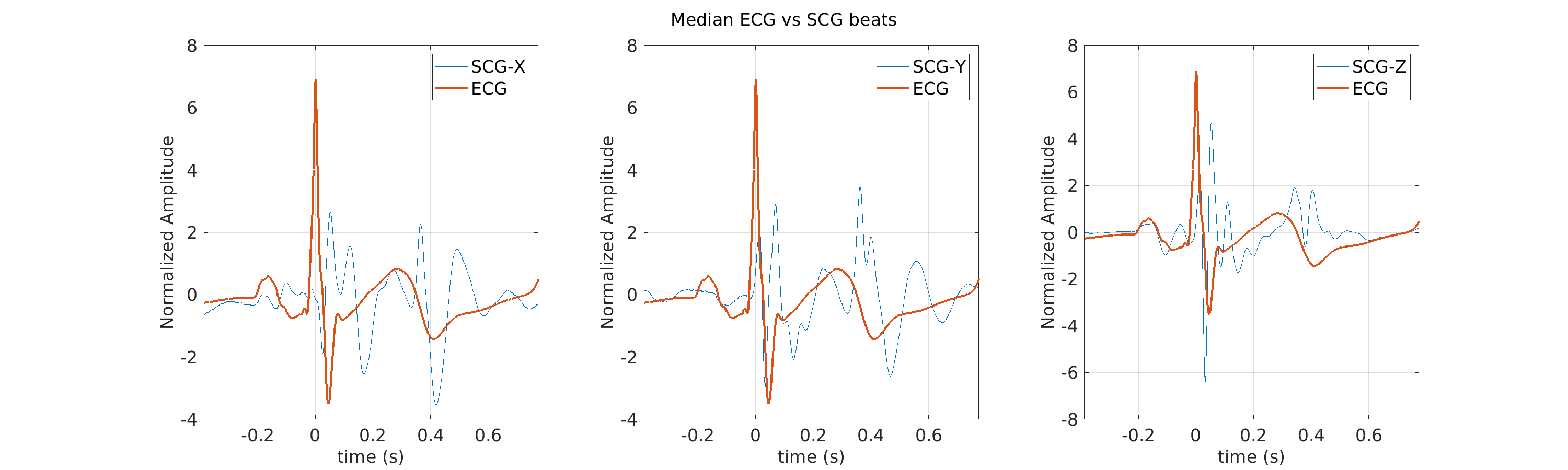 S019_scg_med_ecg_scg