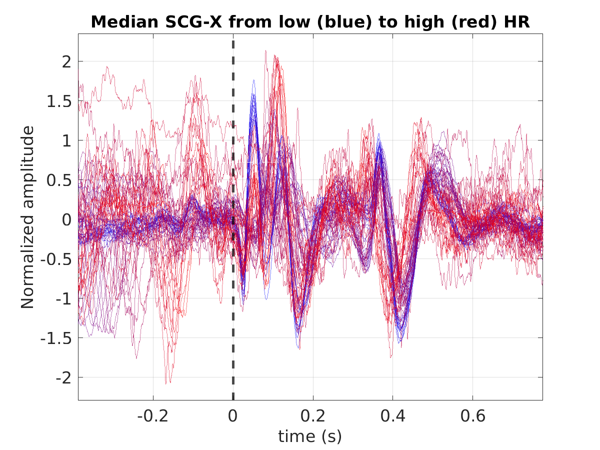 S019_scg_med_scgx_hr_binned_norm