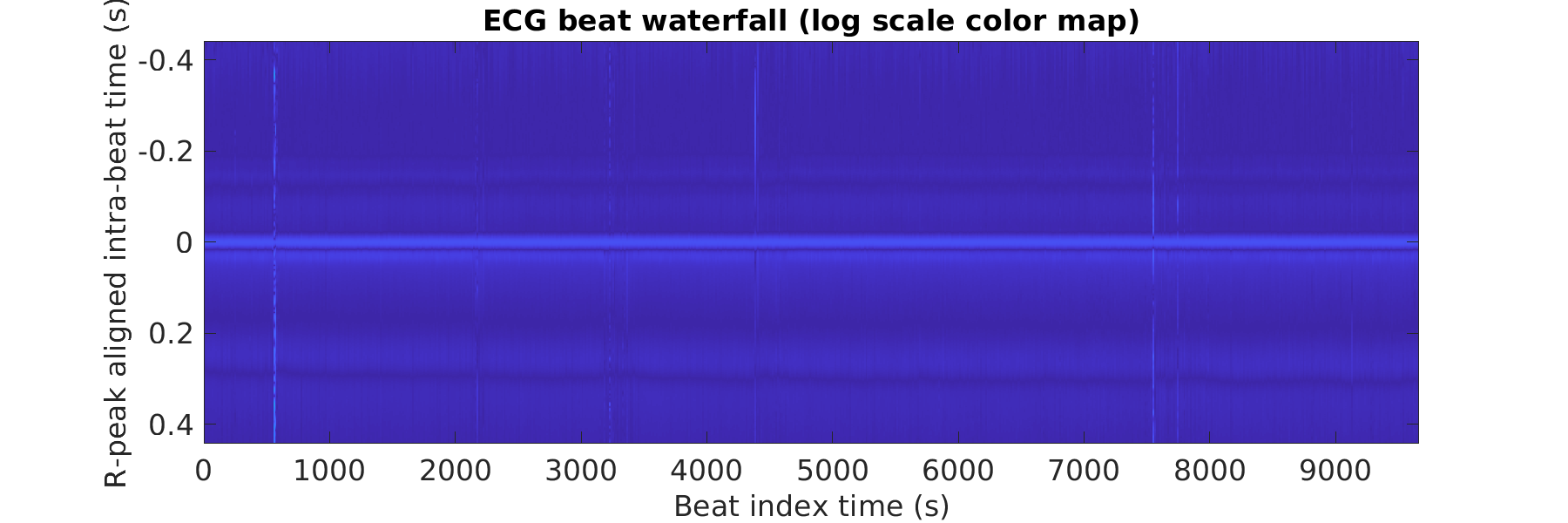 S020_ecg_beats_waterfall_logscale