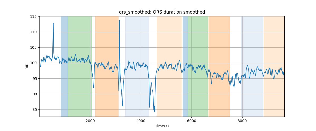 qrs_smoothed: QRS duration smoothed